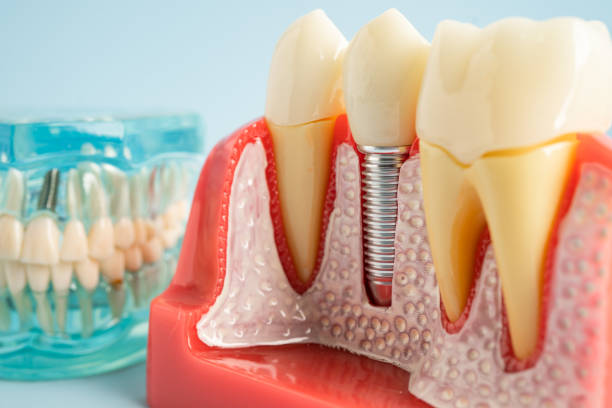 Best Tooth Extraction  in Poughkeepsie, NY